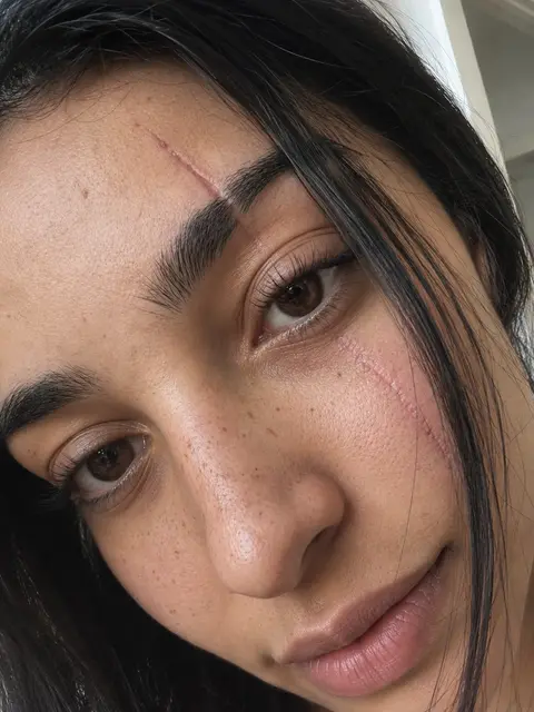 An extreme close-up that argues against flawless skin